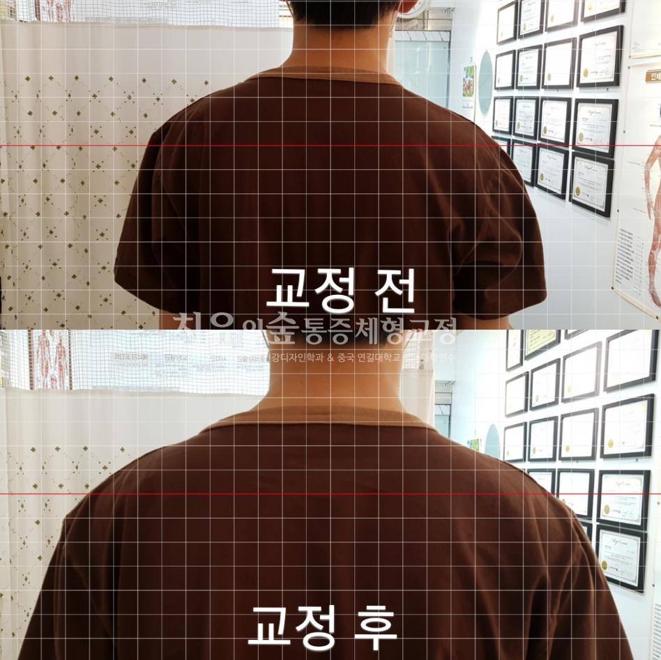 2039197873_J2QV9xY1_24001b8323f4ffb139005cea14ffa7134c1d516c.jpg 이미지크게보기