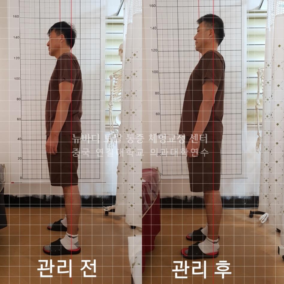 3067753392_6xawm5Df_b6dd55ac6cfaf490f43bb3345d8d0edea703328f.jpg 이미지크게보기