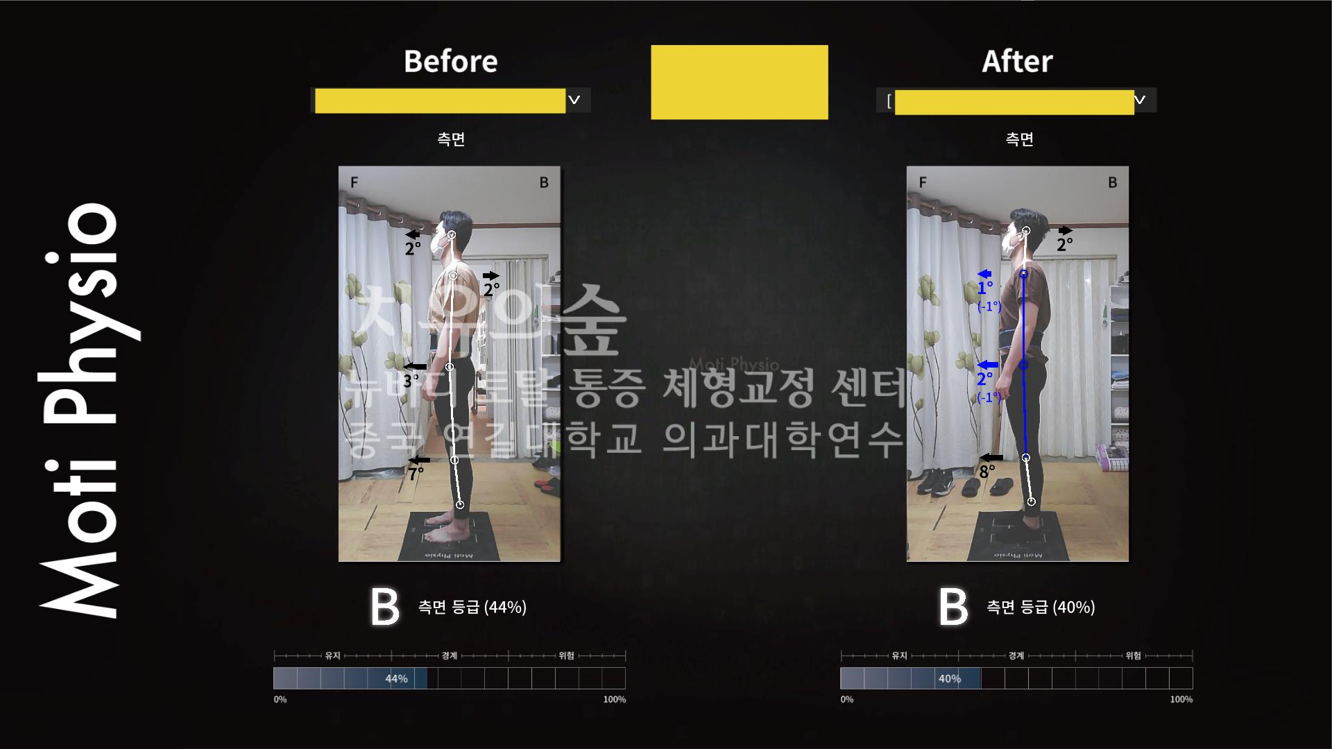 /user/c/cureforest/editor/2110/0caeb226ca099204189c4e1e5fe26117_1634665538_7207.png 이미지크게보기