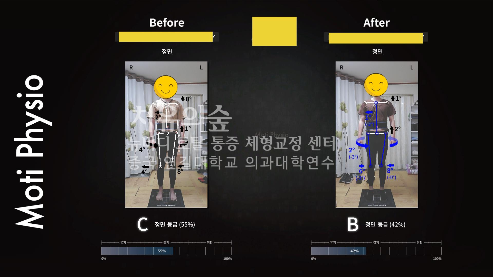 /user/c/cureforest/editor/2110/0caeb226ca099204189c4e1e5fe26117_1634665568_3744.png 이미지크게보기