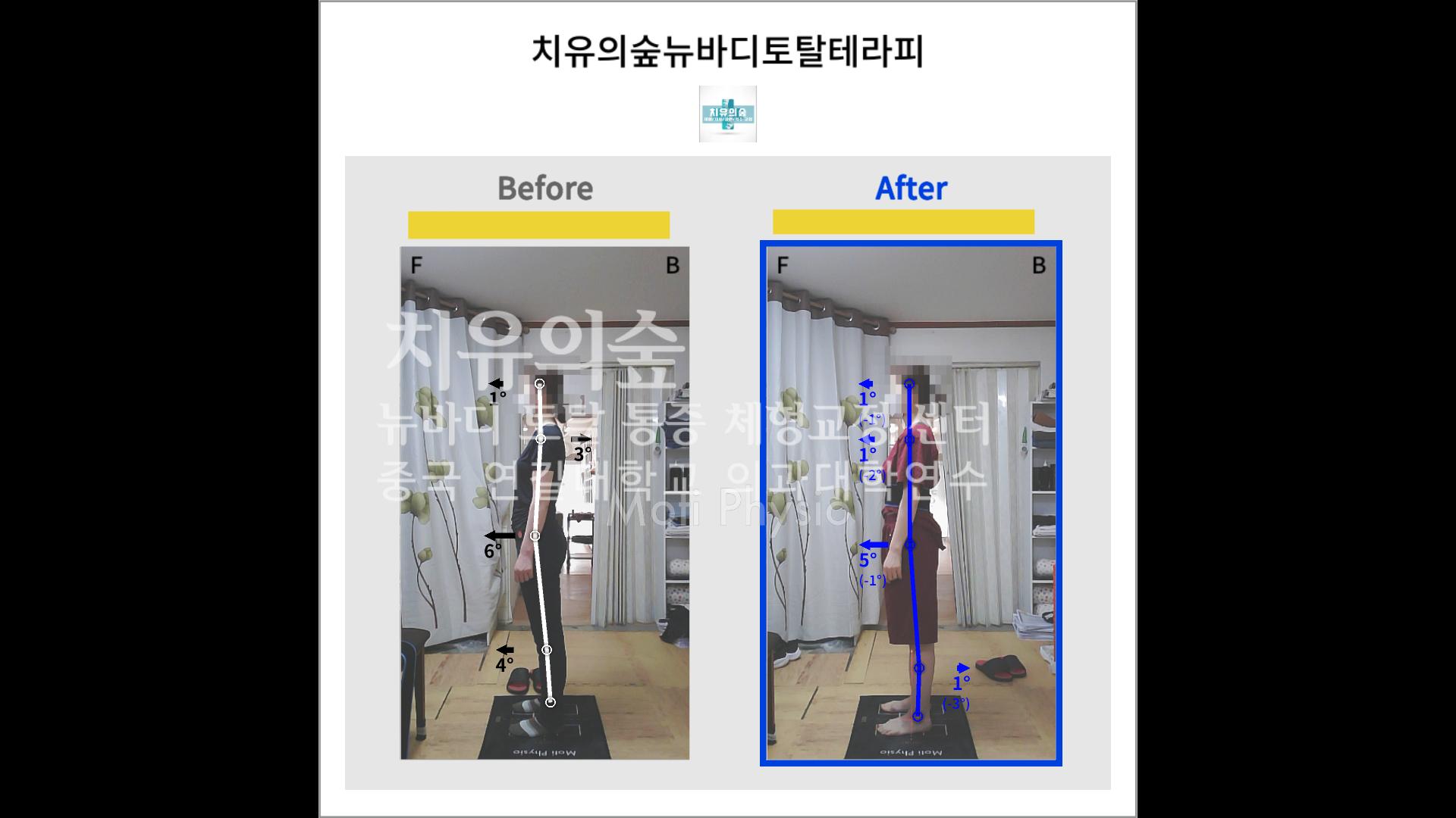 /user/c/cureforest/editor/2110/0caeb226ca099204189c4e1e5fe26117_1634665659_003.png 이미지크게보기