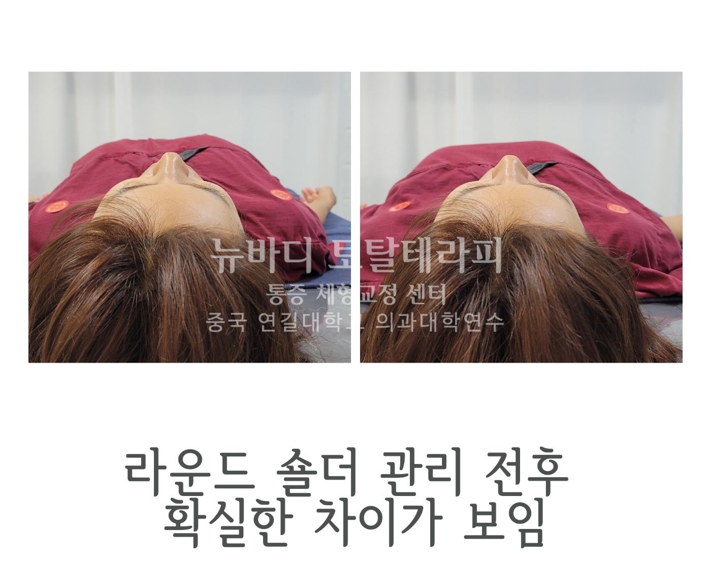 /user/c/cureforest/editor/2312/38d385d52e346ee240d1ef90b3aa401e_1703942604_6931.jpg 이미지크게보기