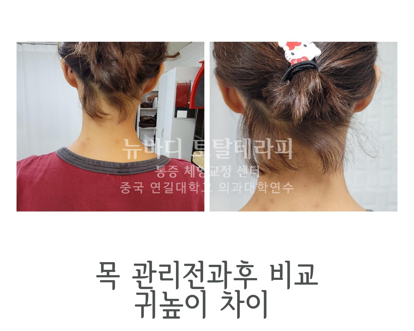 /user/c/cureforest/editor/2312/38d385d52e346ee240d1ef90b3aa401e_1703942617_0415.jpg 이미지크게보기