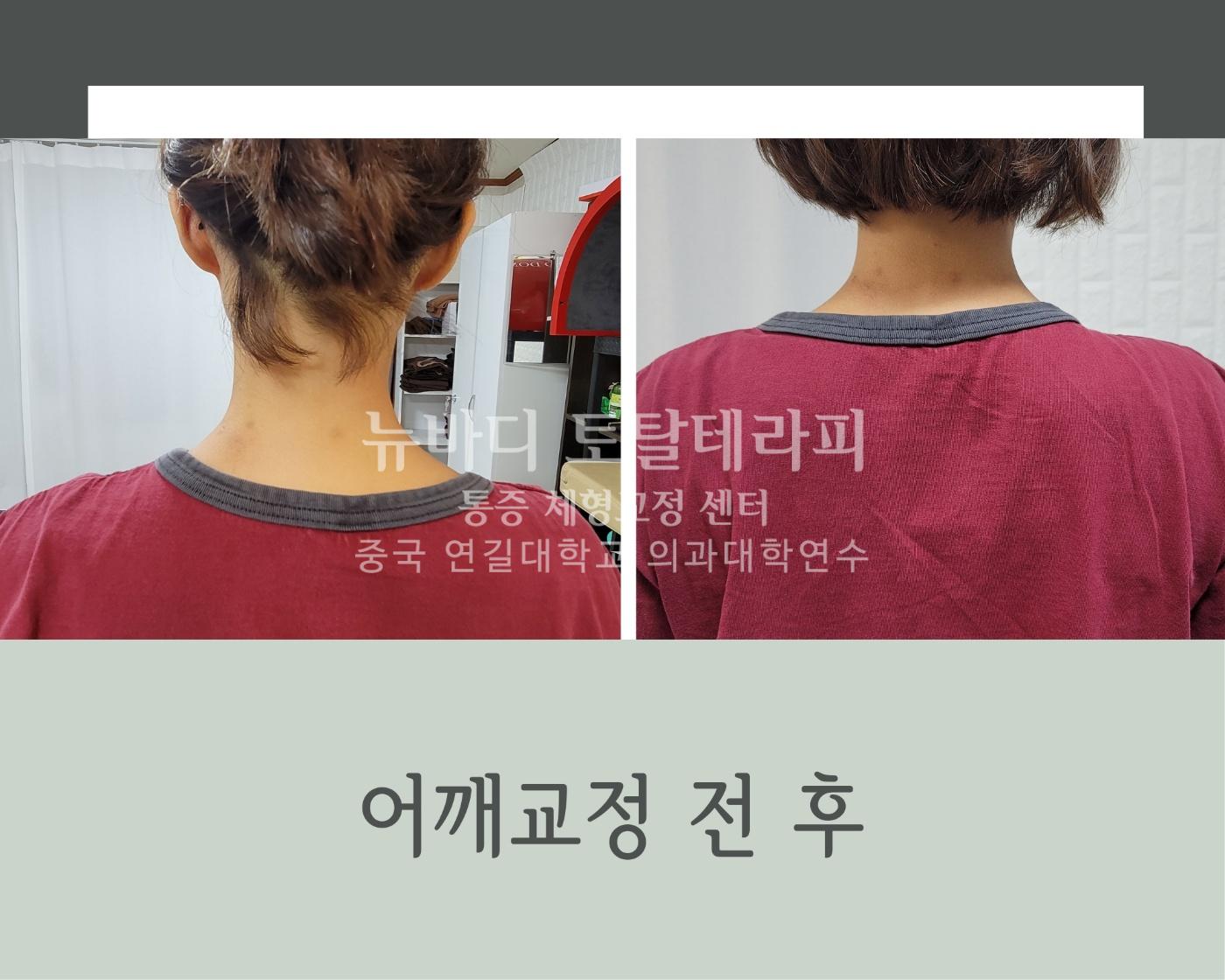 /user/c/cureforest/editor/2312/38d385d52e346ee240d1ef90b3aa401e_1703942783_0549.jpg 이미지크게보기